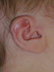 Samantha's very cute ear